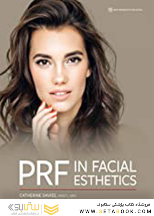 PRF in Facial EstheticsPRF