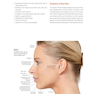 PRF in Facial EstheticsPRF