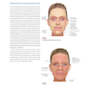 PRF in Facial EstheticsPRF