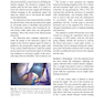 Augmentation Mastopexy: Mastering the Art in the Management of the Ptotic