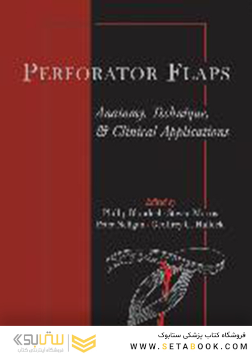 Perforator Flaps: Anatomy, Technique, - Clinical Applications2013