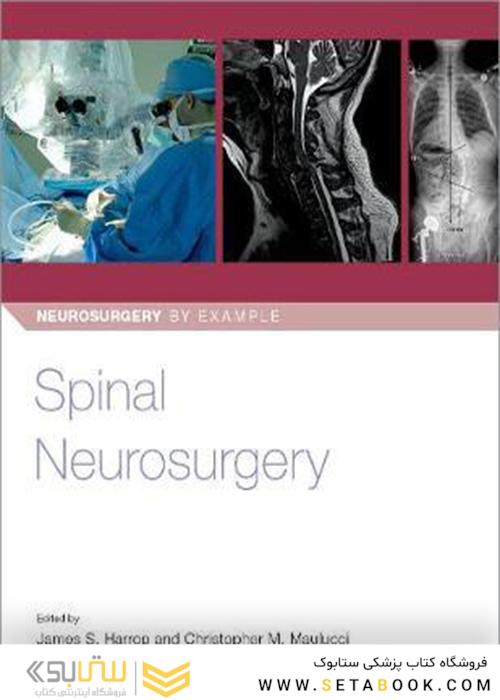 Spinal Neurosurgery (Neurosurgery by Example)2019جراحی مغز و اعصاب نخاعی (جراحی مغز و اعصاب به عنوان مثال)