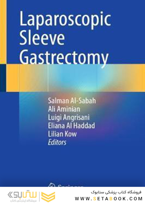 Laparoscopic Sleeve Gastrectomy2021آستین کامل معده