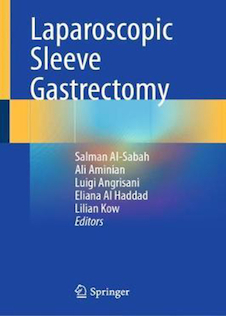 عکس Laparoscopic Sleeve Gastrectomy2021آستین کامل معده