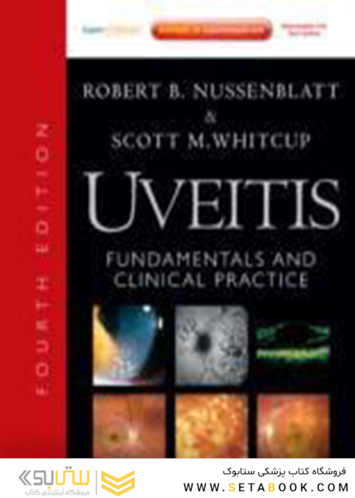 Uveitis: Fundamentals and Clinical Practice: Expert Consult - Online and Print2011یوئیت: اصول و عمل بالینی: مشاوره متخصص - بصورت آنلاین و چاپی