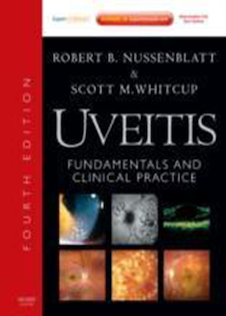 عکس Uveitis: Fundamentals and Clinical Practice: Expert Consult - Online and Print2011یوئیت: اصول و عمل بالینی: مشاوره متخصص - بصورت آنلاین و چاپی