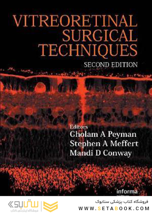 Vitreoretinal Surgical Techniques, Second Edition 2nd Edition2006n, Kindle Edition تکنیک های جراحی ویتروتورینال ، چاپ دوم