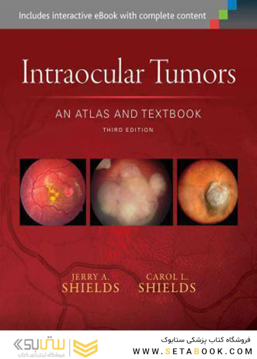 Intraocular Tumors: An Atlas and Textbook (Volume 1)2015تومورهای داخل چشم: اطلس و کتاب درسی (جلد 1)