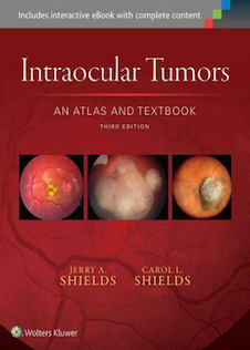 عکس Intraocular Tumors: An Atlas and Textbook (Volume 1)2015تومورهای داخل چشم: اطلس و کتاب درسی (جلد 1)