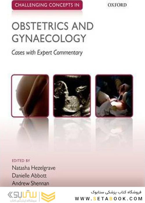 Challenging Concepts in Obstetrics and Gynaecology: Cases with Expert Commentary2015