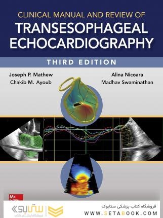 راهنمای بالینی و بررسی اکوکاردیوگرافی انتقال دهنده Clinical Manual and Review of Transesophageal Echocardiography