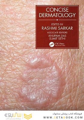 Concise Dermatology, 1st Edition