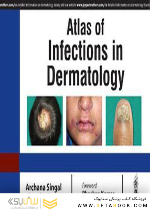 Atlas Of Infections In Dermatology2019اطلس عفونت در پوست
