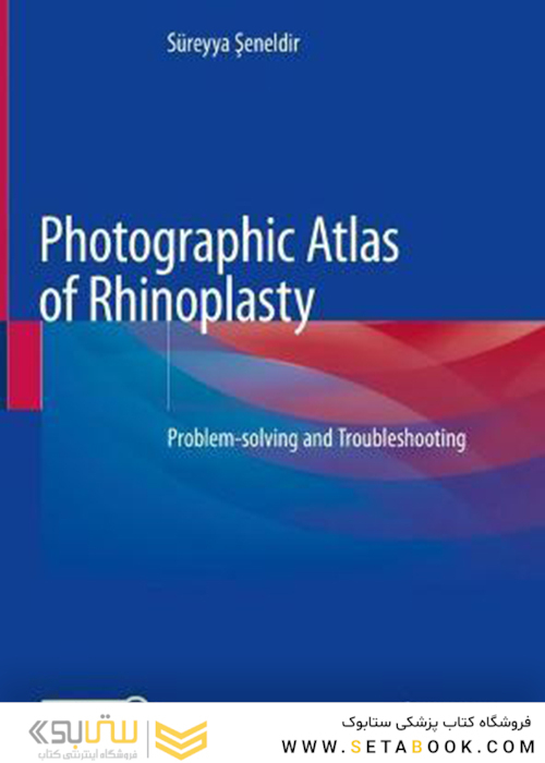 Photographic Atlas of Rhinoplasty : Problem-solving and Troubleshooting