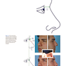 Photographic Atlas of Rhinoplasty : Problem-solving and Troubleshooting