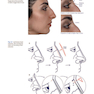 Photographic Atlas of Rhinoplasty : Problem-solving and Troubleshooting