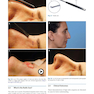 Photographic Atlas of Rhinoplasty : Problem-solving and Troubleshooting