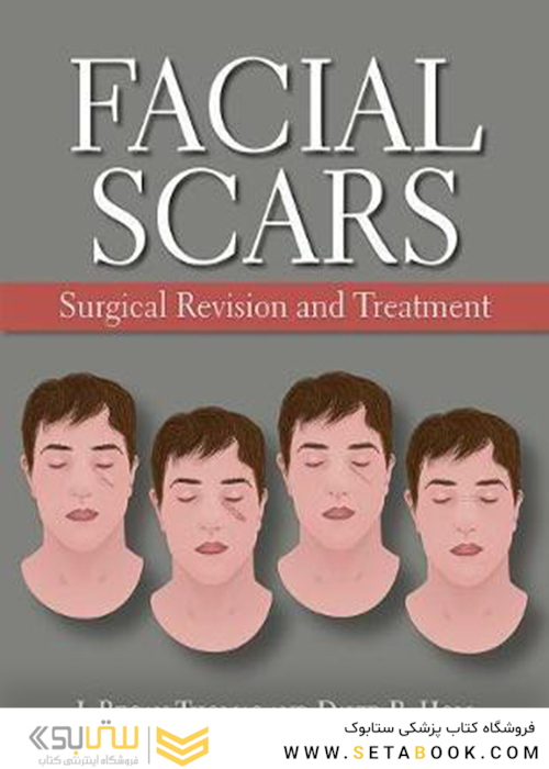Facial Scars: Surgical Revision and Treatmentاسکارهای صورت: تجدید نظر و درمان جراحی