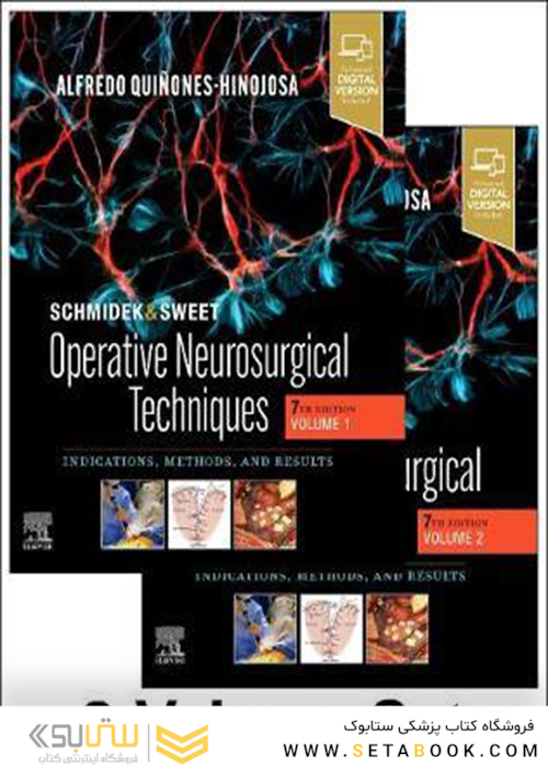 Schmidek and Sweet: Operative Neurosurgical Techniques 2-Volume Set: Indications, Methods and Results2021