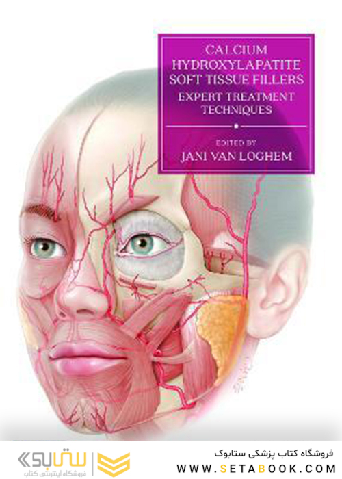 Calcium Hydroxylapatite Soft Tissue Fillers: Expert Treatment Techniquesپرکننده های بافت نرم هیدروکسیلاپاتیت کلسیم