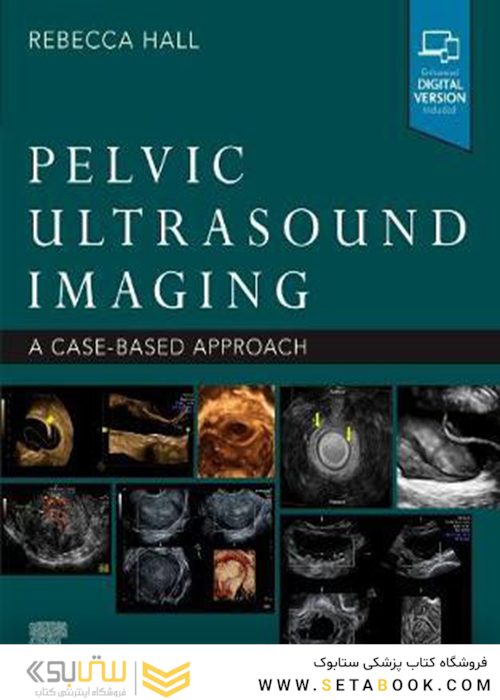 Pelvic Ultrasound Imaging: A Cased-Based Approachتصویربرداری سونوگرافی لگن