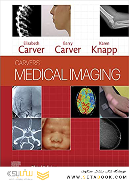Medical Imaging : Techniques, Reflection and Evaluation2021تصویربرداری پزشکی