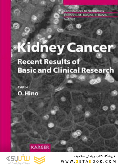 Kidney Cancer: Recent Results of Basic and Clinical Research (Contributions to Nephrology, Vol. 128)1999سرطان کلیه