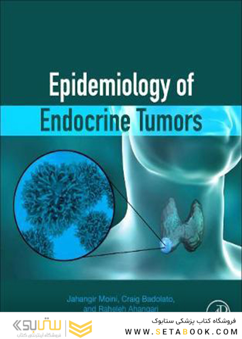 Epidemiology of Endocrine Tumors2021اپیدمیولوژی تومورهای غدد درون ریز