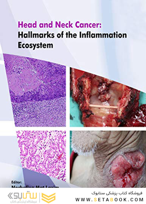 Head and Neck Cancer: Hallmarks of The Inflammation Ecosystem-Volume 2  2021 سرطان سر و گردن: نشانه های اکوسیستم التهاب-جلد 2