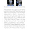 Intensity Modulated Radiation Therapy : A Clinical Overview 2021