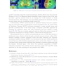 Intensity Modulated Radiation Therapy : A Clinical Overview 2021
