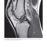 Photographic Atlas of Anatomy2021