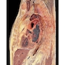 Photographic Atlas of Anatomy2021