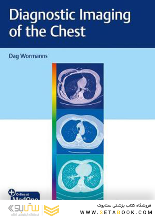 Diagnostic Imaging of the Chest 2020