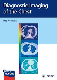 عکس Diagnostic Imaging of the Chest 2020