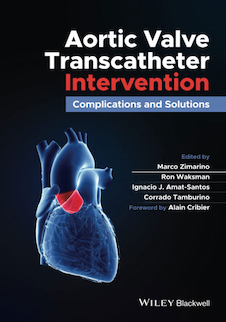 عکس Aortic Valve Transcatheter Intervention: Complications and Solutions