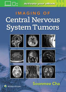 عکس Imaging of Central Nervous System Tumors2021تصویربرداری از تومورهای سیستم عصبی مرکزی