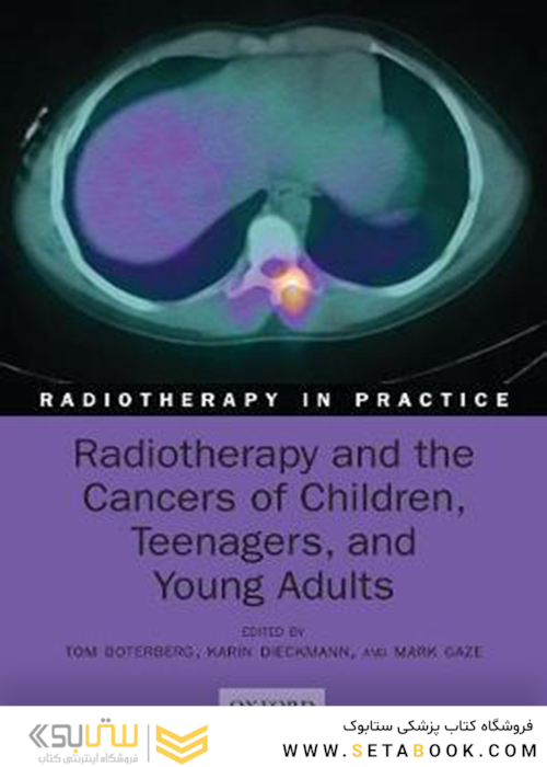 Radiotherapy and the Cancers of Children, Teenagers, and Young Adults2021رادیوتراپی و سرطانهای کودکان ، نوجوانان و جوانان (رادیوتراپی در عمل)