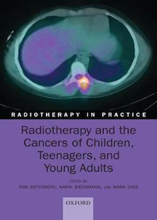 عکس Radiotherapy and the Cancers of Children, Teenagers, and Young Adults2021رادیوتراپی و سرطانهای کودکان ، نوجوانان و جوانان (رادیوتراپی در عمل)