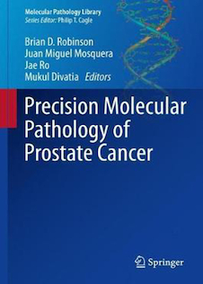 عکس Precision Molecular Pathology of Prostate Cancer2018آسیب شناسی مولکولی دقیق سرطان پروستات