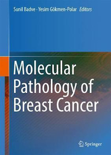 عکس Back to results  Molecular Pathology of Breast Cancer2016آسیب شناسی مولکولی سرطان پستان