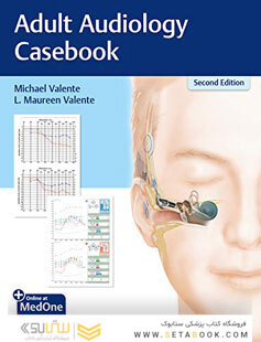 Adult Audiology Casebook 2nd Edicion