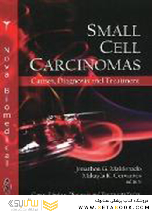 Small Cell Carcinomas : Causes, Diagnosis - Treatment2010سرطان سلولهای کوچک: علل ، تشخیص و درمان