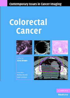 عکس Colorectal Cancer2008سرطان روده بزرگ