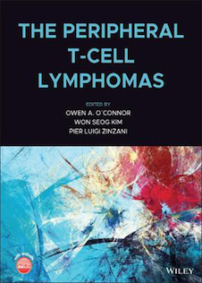 عکس The Peripheral T-Cell Lymphomasلنفوم های سلول T محیطی