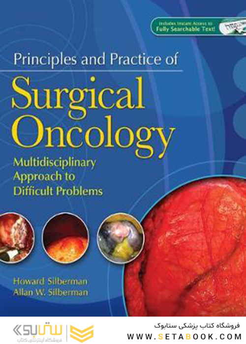Principles and Practice of Surgical Oncology : A Multidisciplinary Approach to Difficult Problems2009