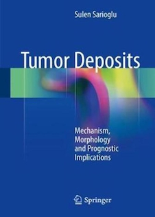 عکس Tumor Deposits: Mechanism, Morphology and Prognostic Implications2018