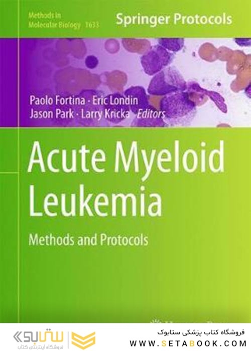 Acute Myeloid Leukemia : Methods and Protocols2017