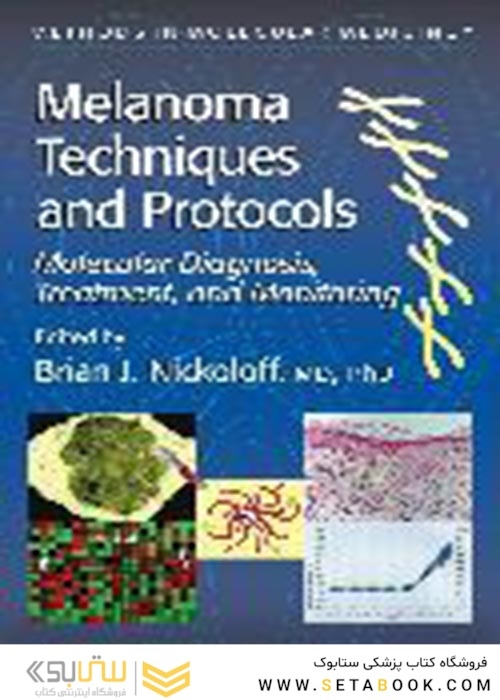 Melanoma Techniques and Protocols : Molecular Diagnosis, Treatment, and Monitoring2001  تکنیک ها و پروتکل های ملانوم: تشخیص مولکولی ، درمان و نظارت