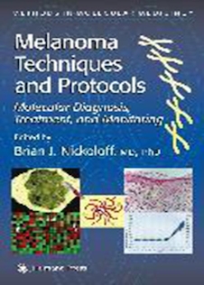 عکس Melanoma Techniques and Protocols : Molecular Diagnosis, Treatment, and Monitoring2001  تکنیک ها و پروتکل های ملانوم: تشخیص مولکولی ، درمان و نظارت